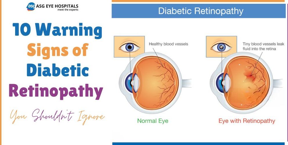 10 Warning Signs of Diabetic Retinopathy You Shouldn't Ignore