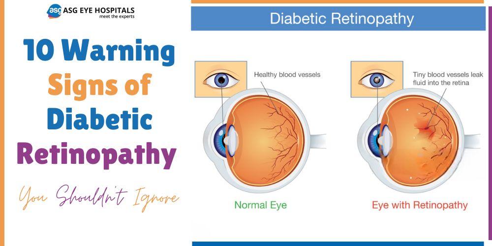 10 Warning Signs of Diabetic Retinopathy You Shouldn't Ignore